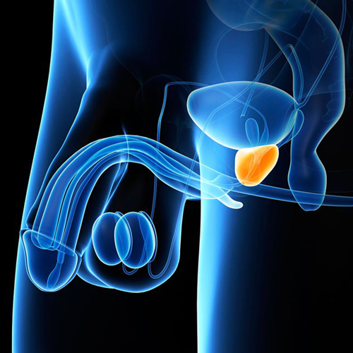 Taking Care of Ones Prostate!